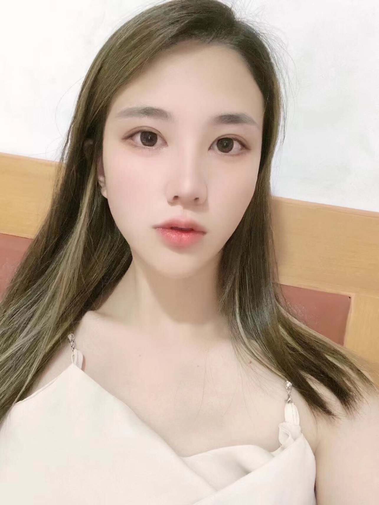 体验前变美诉求:眼睛小,无神,上眼皮肤松弛.