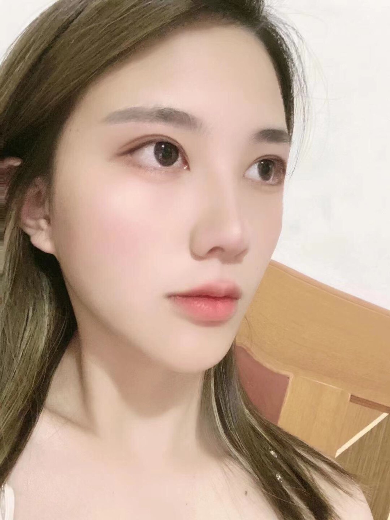 体验前变美诉求:眼睛小,无神,上眼皮肤松弛.