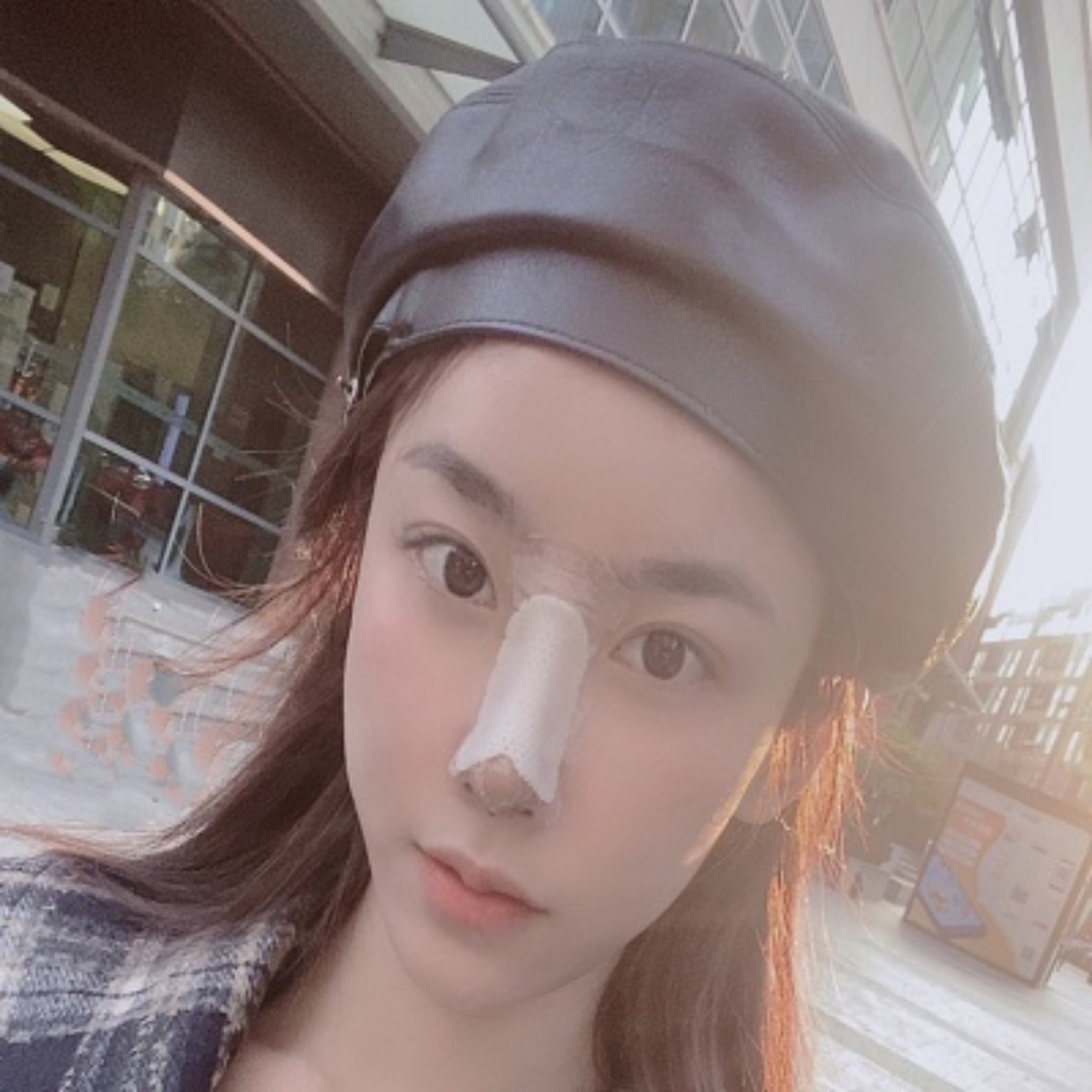 肋骨鼻术后第五天,今天贴了防水胶布给自己好好洗了个_圈子-新氧美容