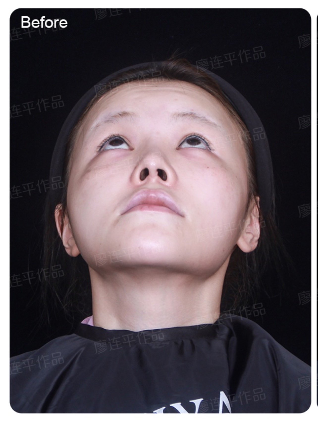 鼻子短鼻孔外露的女人图片