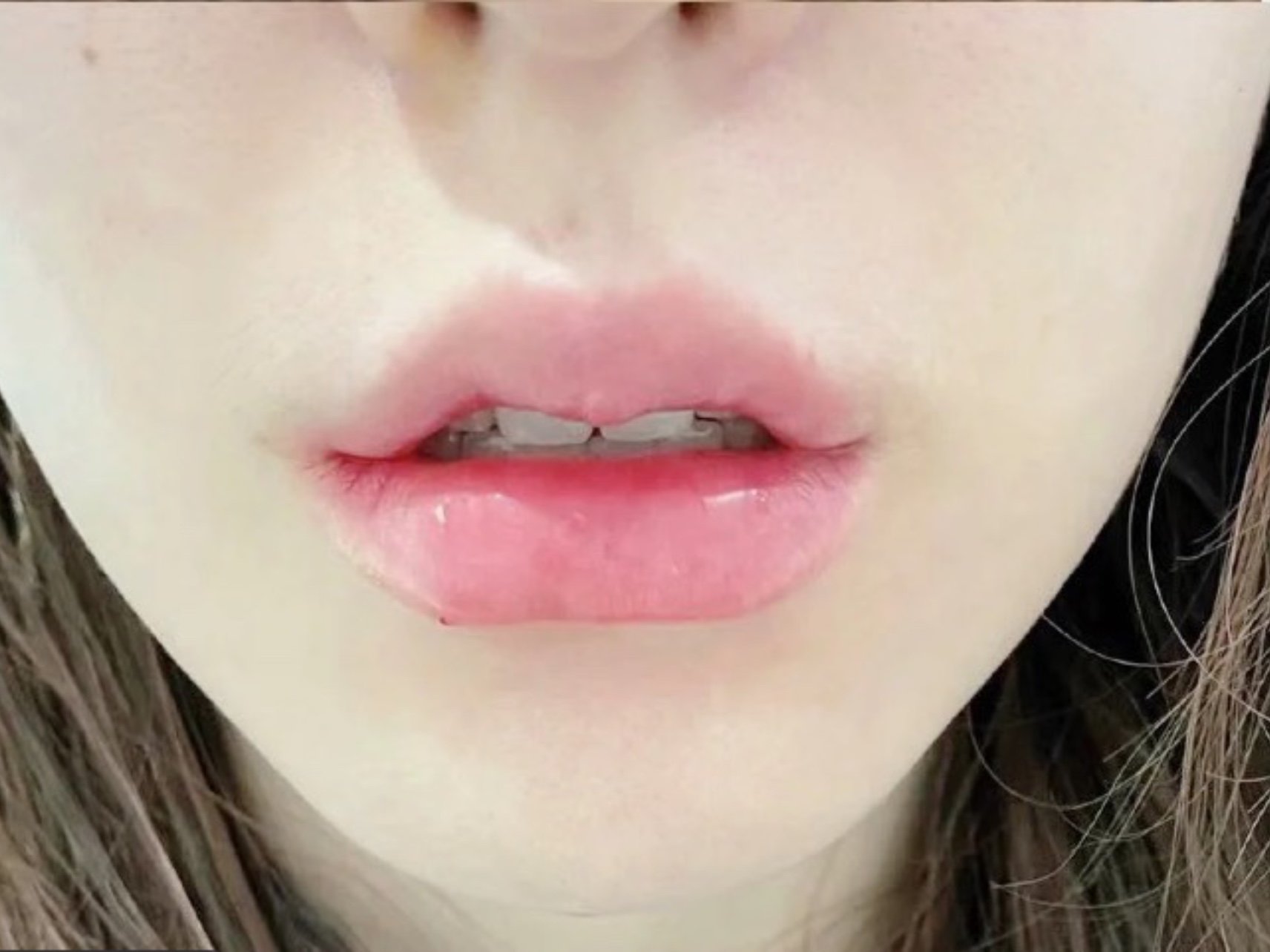 97丰唇是不是想怎_圈子-新氧美容整形