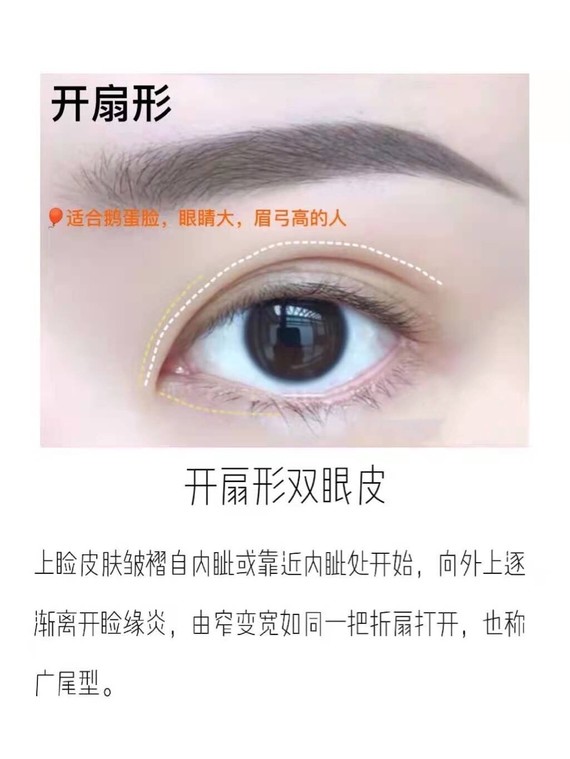 科普时间看看你适合什么形状的双眼皮