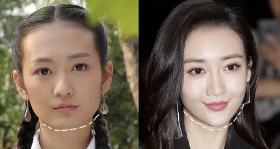 王鸥原本的下巴偏圆下庭偏短.与她上半脸的美艳也是不搭的.