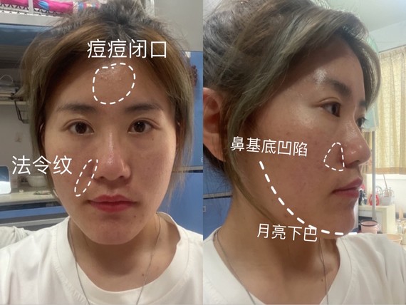 素人看脸丨月亮脸如何改善71今天看脸的这位小姐姐,五_圈子-新氧