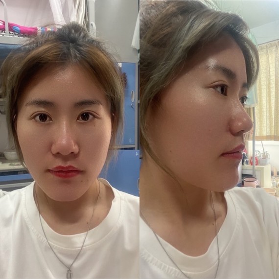 素人看脸丨月亮脸如何改善71今天看脸的这位小姐姐,五_圈子-新氧