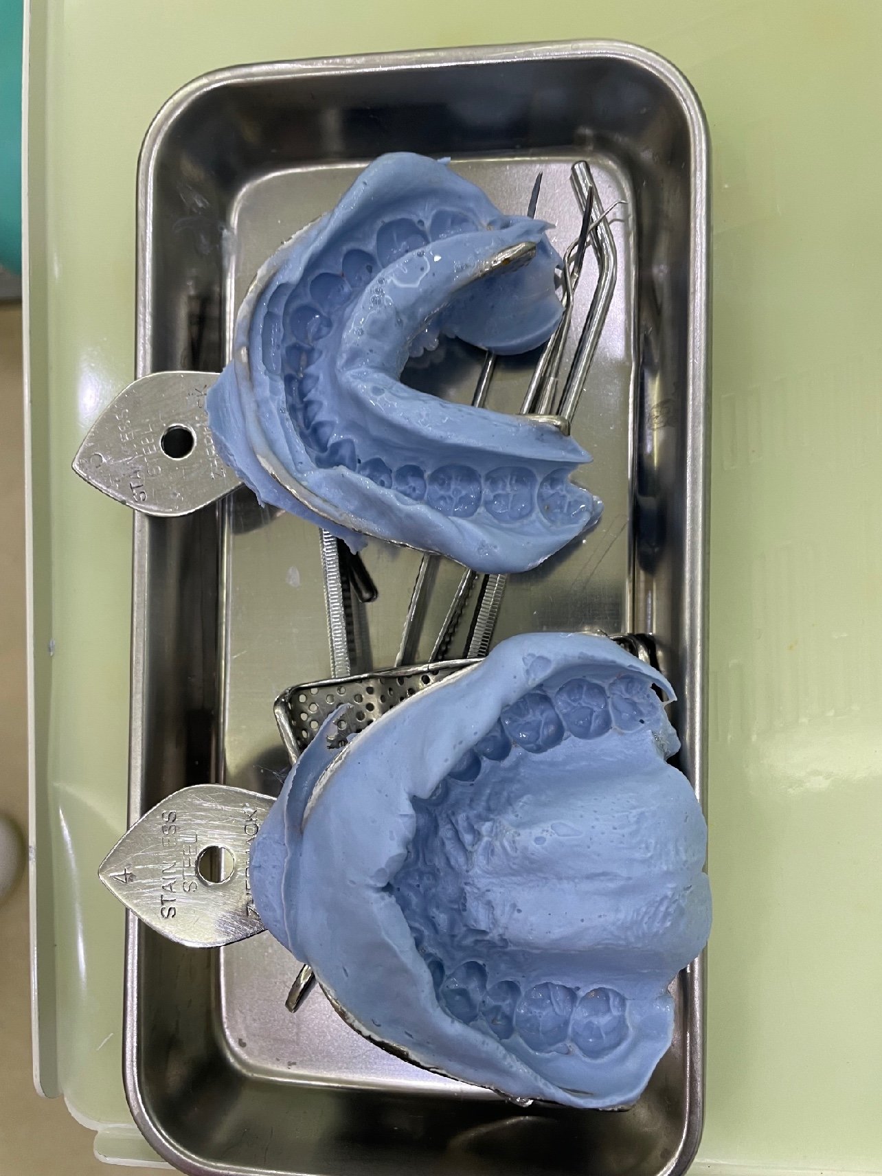 洗牙完成后,就是等待取模了—=≡∑((( つ 3 )つ