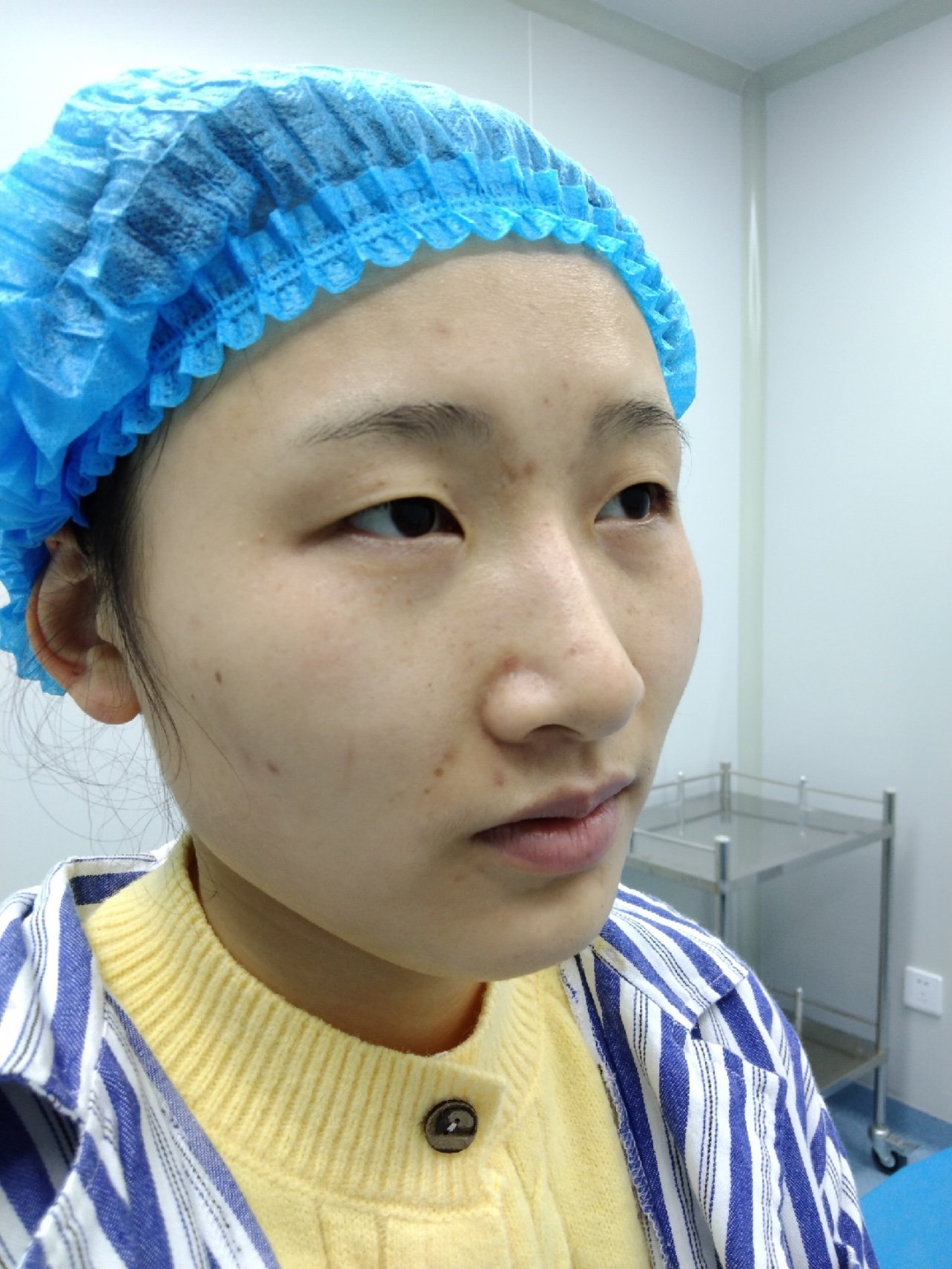 [:163]体验前变美诉求:单眼皮天生的,眼睛细长_圈子-新氧美容整形