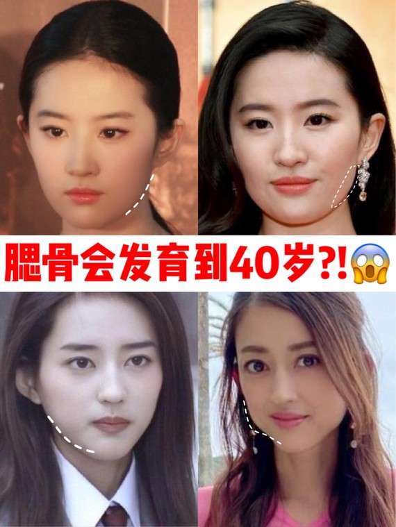 太可怕了,原来腮骨会一直发育到40岁75那方脸的