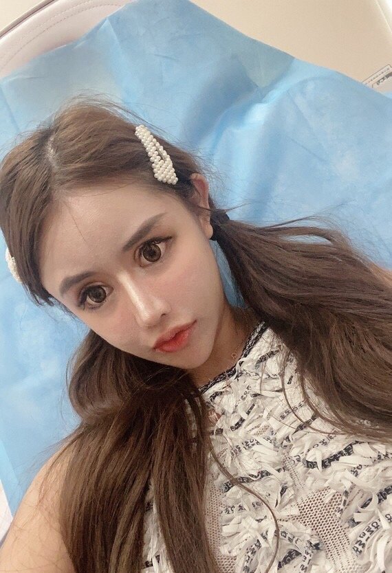 05p图大赛|拯救古早蛇精脸网红大作战7515整形