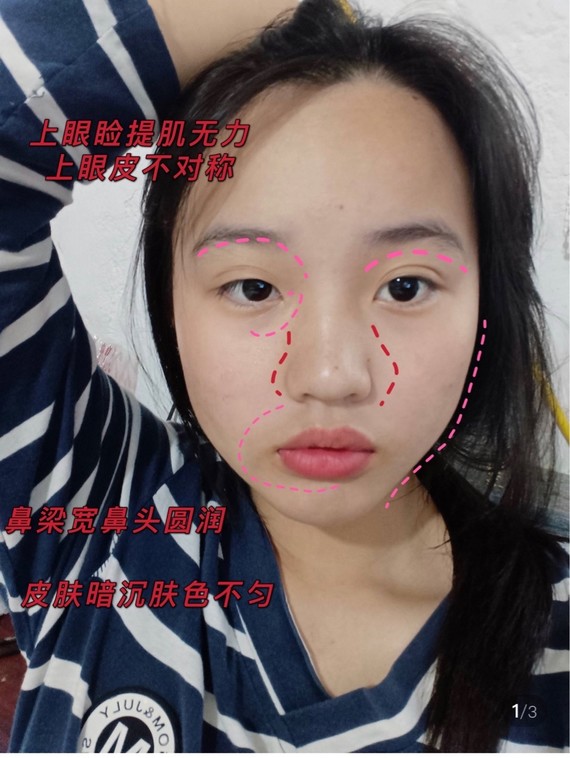 素人看脸如何打造幼态少女脸71717171