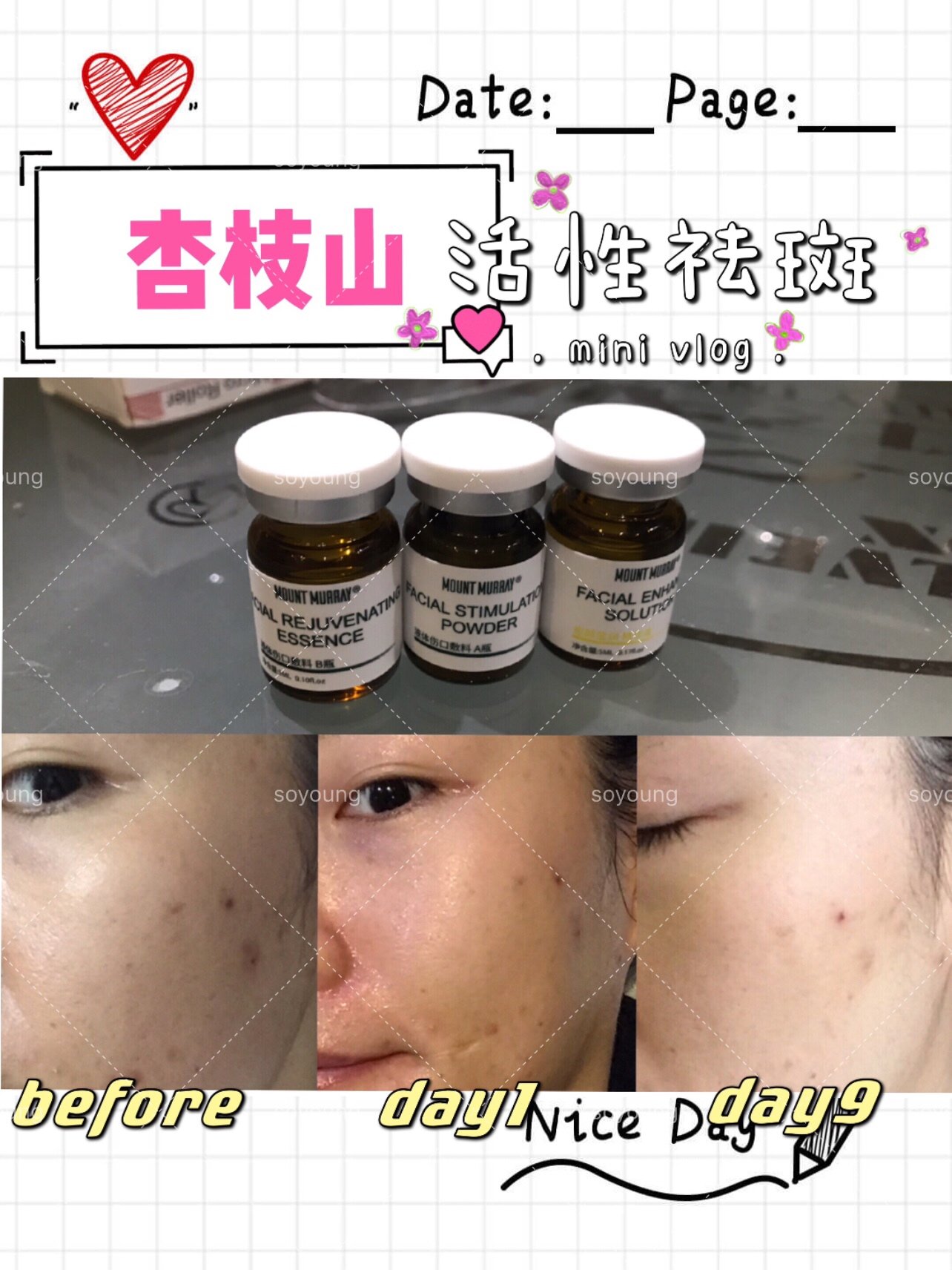 9595大家好啊,距离体验杏枝山祛斑微针已经10天的时_圈子-新氧