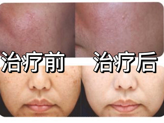 时下流行的cc光是什么?它的_圈子-新氧美容整形