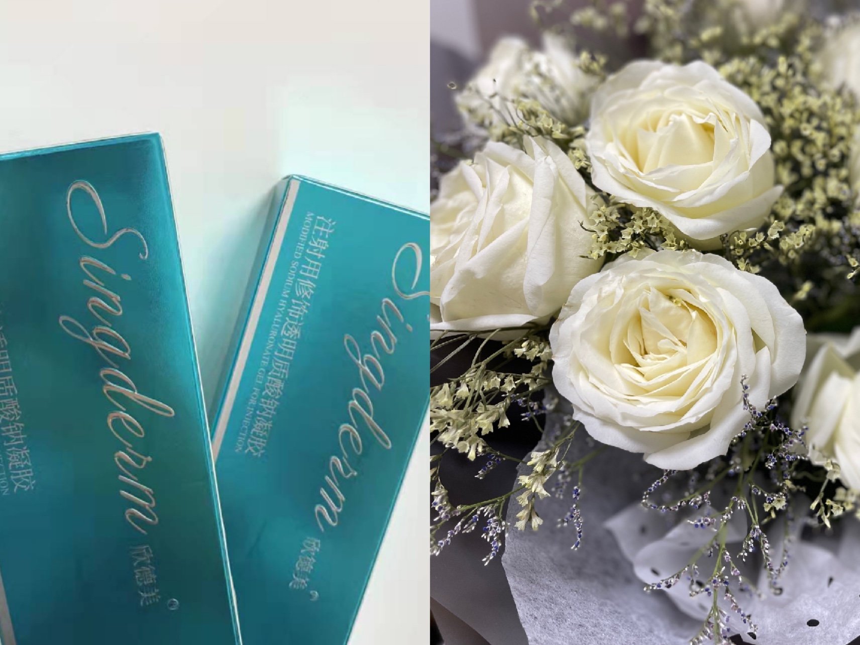 欣德美玻尿酸治疗后第7天