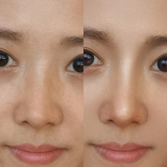 这个小姐姐已经很漂亮啦,典型的幼态脸,不改幼态脸的_圈子-新氧美容