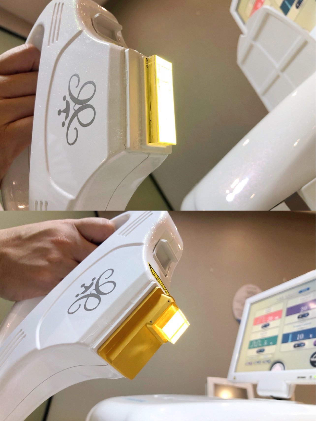 在整个奇致cc光的体验过程中,有两点感受特别令人感_圈子-新氧美容