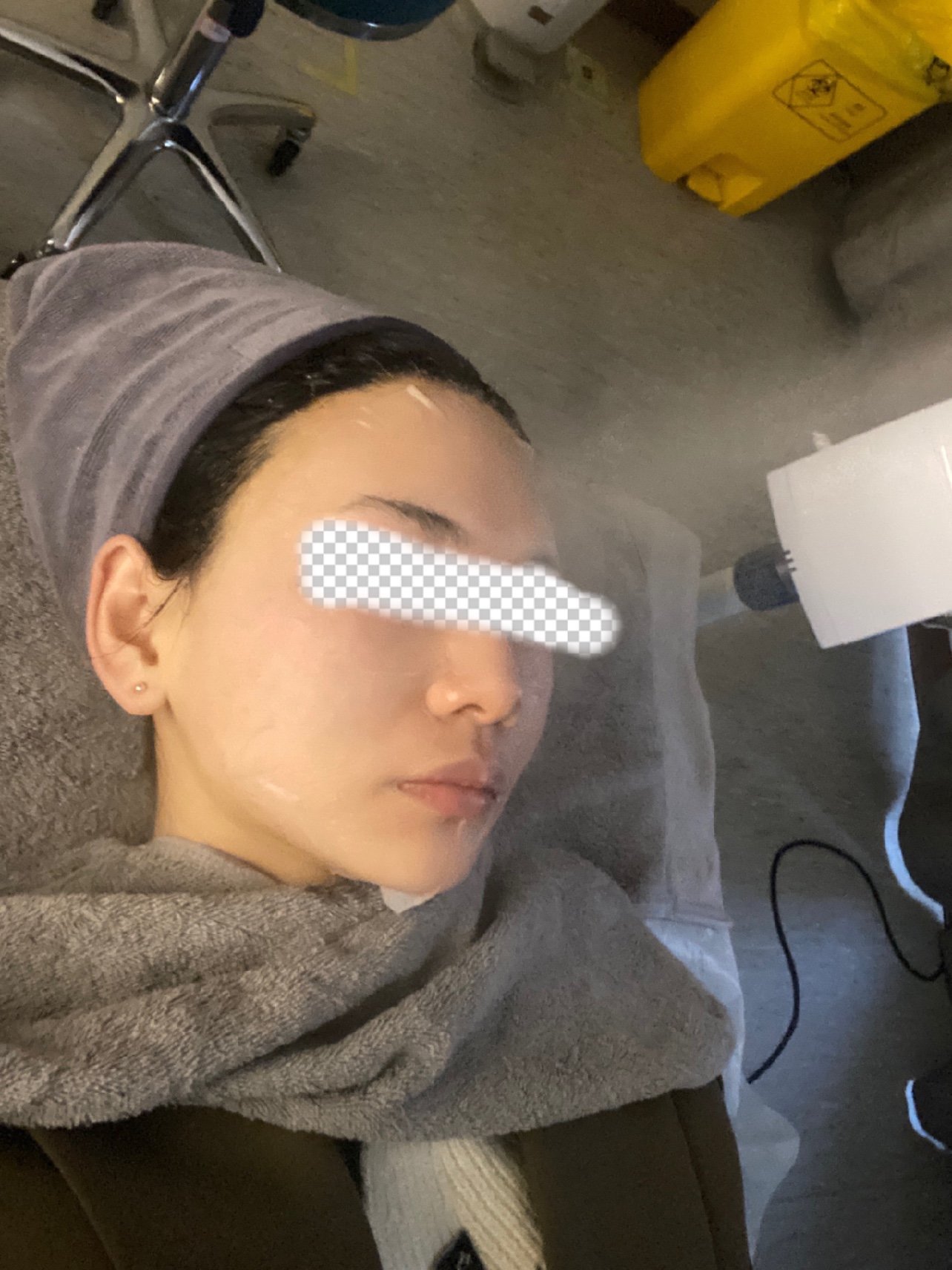 endymed美迪迈黄金射频微针体验感受