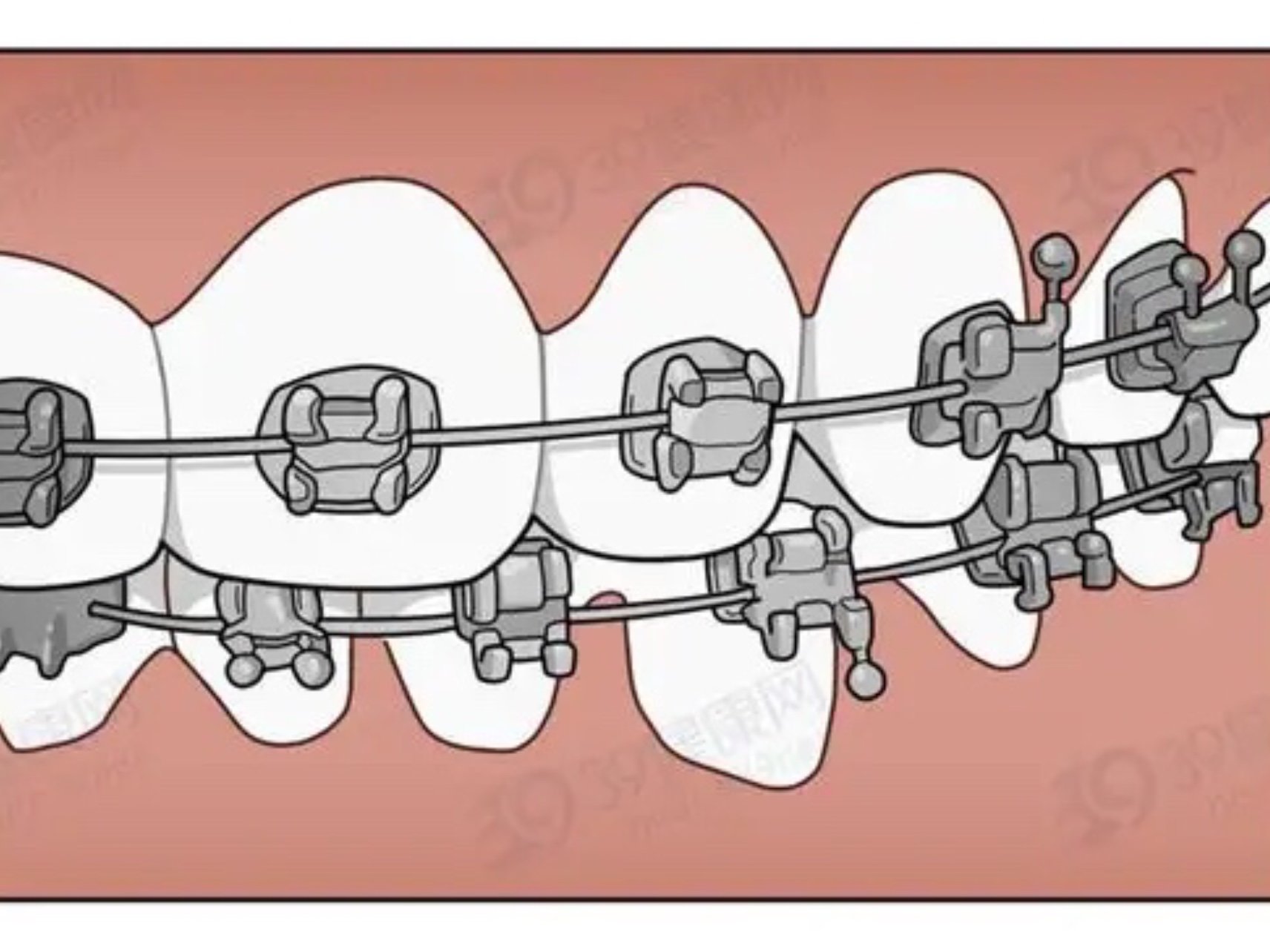 成年人生长发育基本已经停止,牙槽骨改建也比较缓慢,_圈子-新氧美容