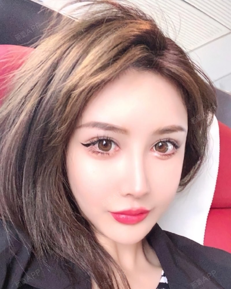 变美诉求:作为一个腮帮子大的大脸妹,打瘦脸是我一直_圈子-新氧美容