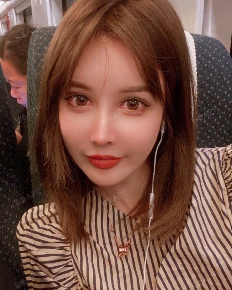 变美诉求:作为一个腮帮子大的大脸妹,打瘦脸是我一直_圈子-新氧美容