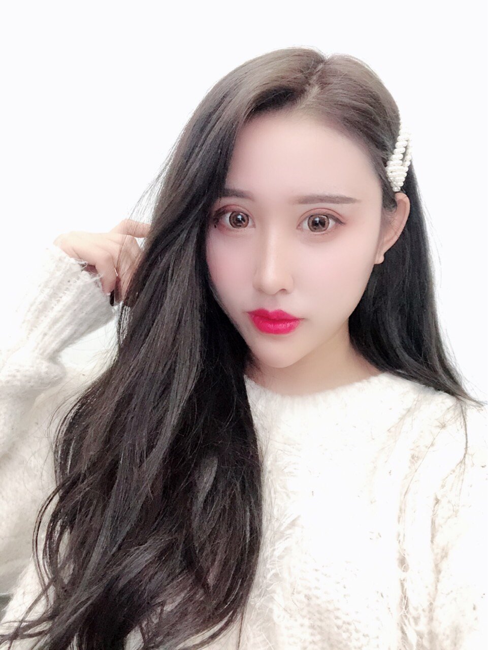 【切开双眼皮】眼部整形 baby翘睫全切双眼皮 祛皮祛脂 避开血管 分层