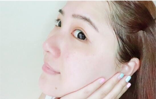 很正规的医院,服务很很棒,做完水氧回家皮肤感觉水嫩嫩的,补水效果挺