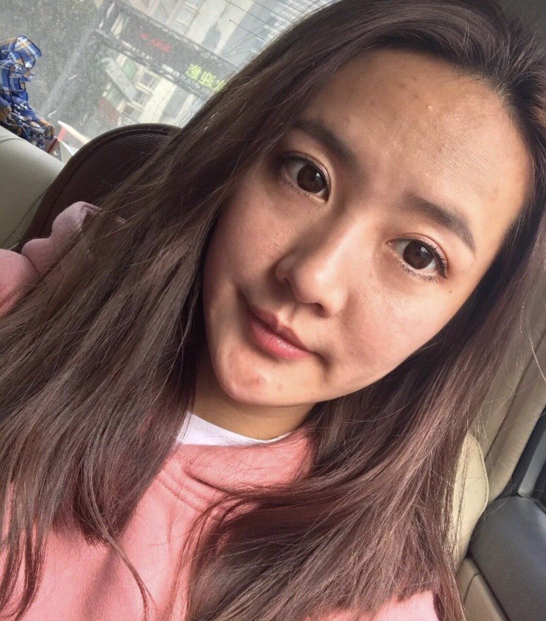 毛孔大,肤色暗沉不均,爱长痘痘,t区超级爱出油,夏天简直是大油田.