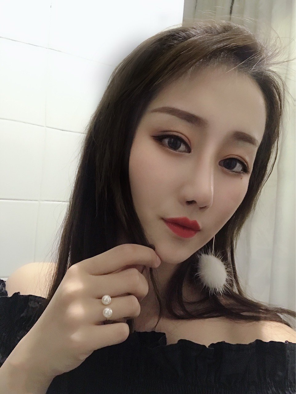 之前在其他医院做的单纯假体隆鼻,假体下滑,有点顶穿_圈子-新氧美容