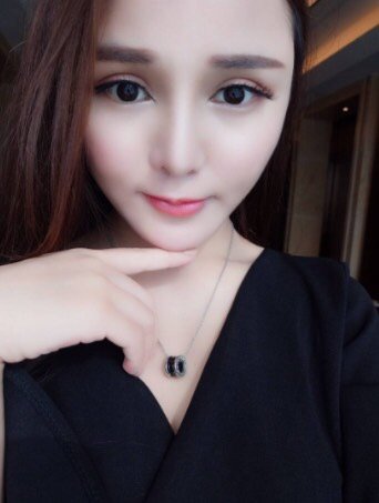 【鼻部多项】【鼻部6项】艳冠假体 耳软骨鼻尖 鼻头抬高 鼻唇角 鼻头