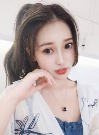 【鼻部多项】【鼻部6项】艳冠假体 耳软骨鼻尖 鼻头抬高 鼻唇角 鼻头