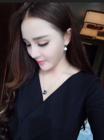 【鼻部多项】【鼻部6项】艳冠假体 耳软骨鼻尖 鼻头抬高 鼻唇角 鼻头