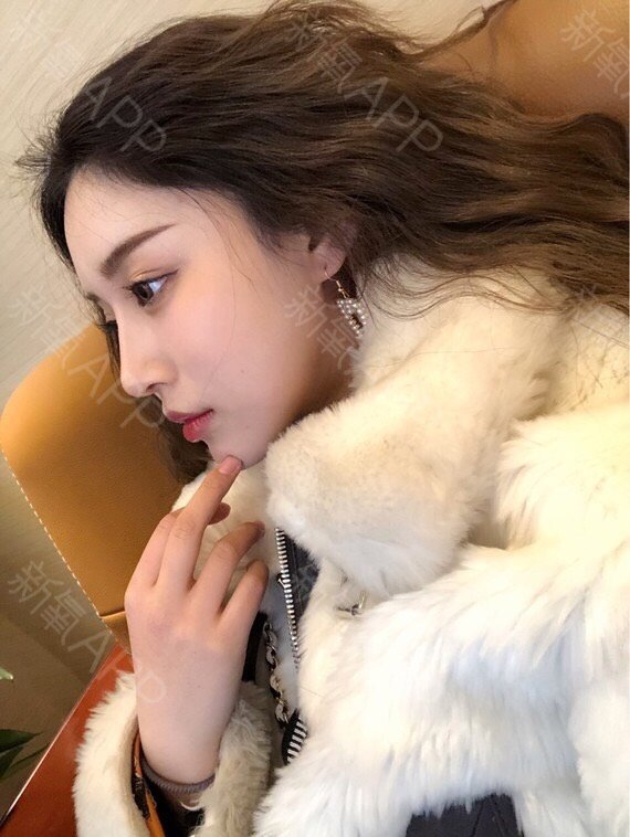 谁都喜欢挺拔的鼻子,我也是哦,一直就羡慕鼻梁高的人_圈子-新氧美容