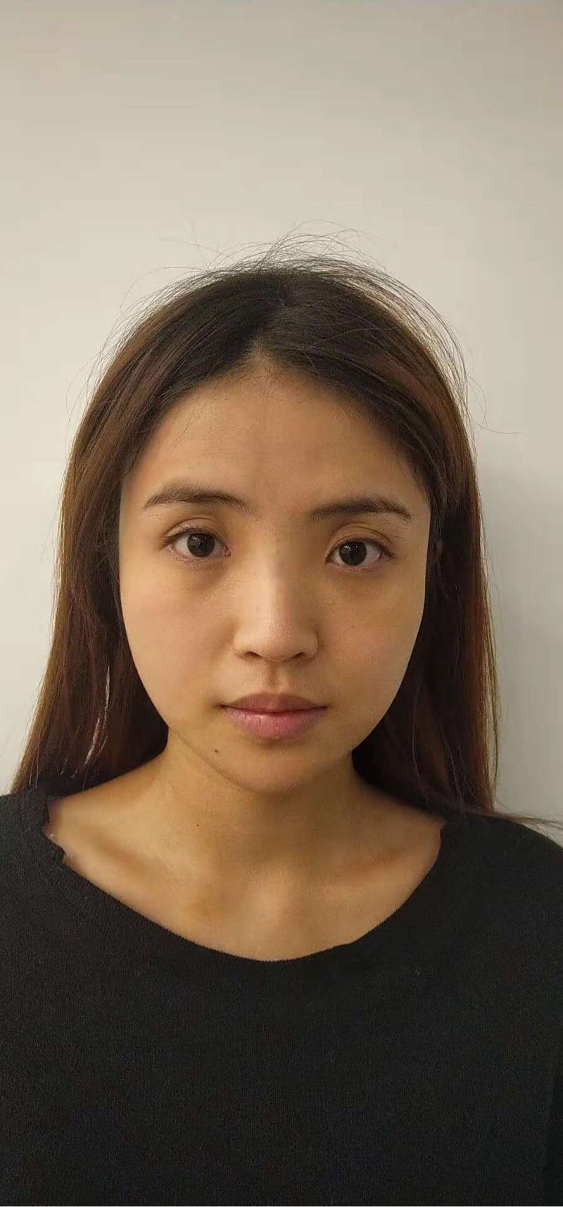 我是挺喜欢看高鼻梁大眼睛的美女的,一直感觉自己的鼻_圈子-新氧美容