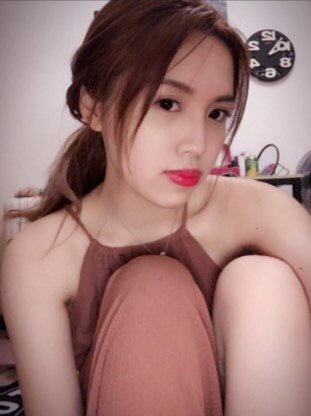 【买一赠一】【埋线提升】【全脸美迪塑埋线提升】