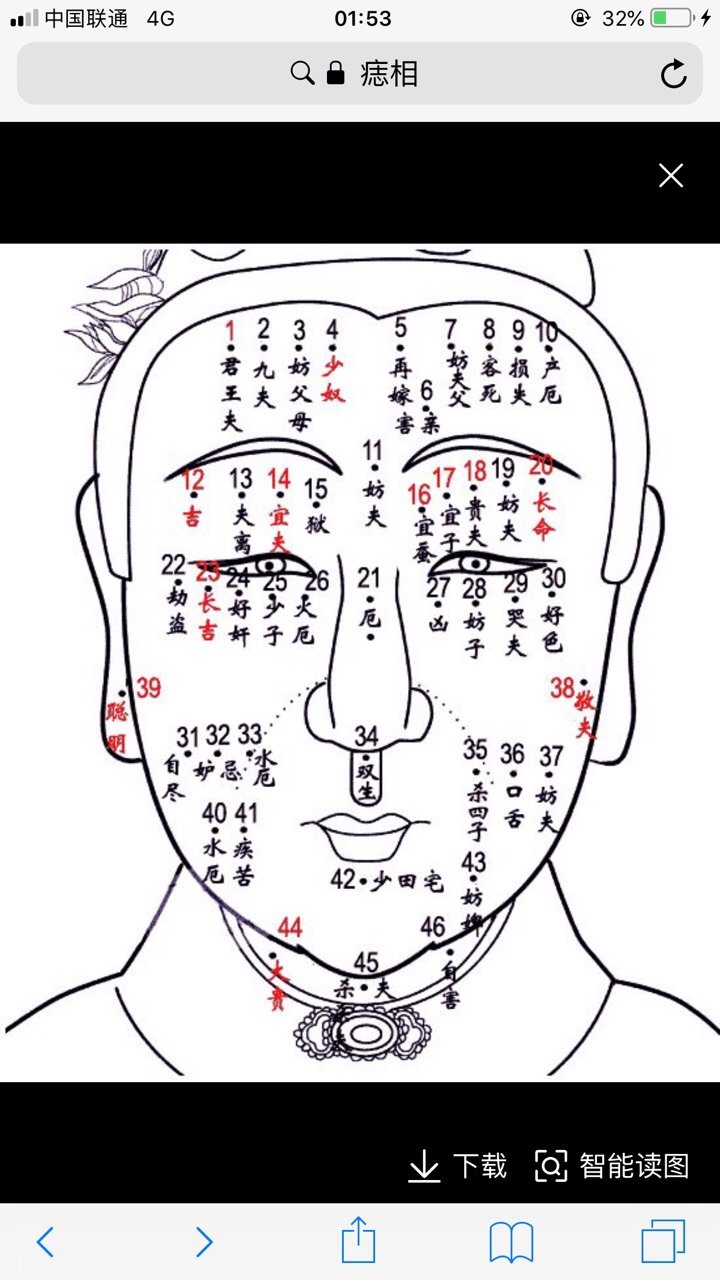 痣,在医学上称作痣细胞或黑素细胞痣,是表皮,真皮