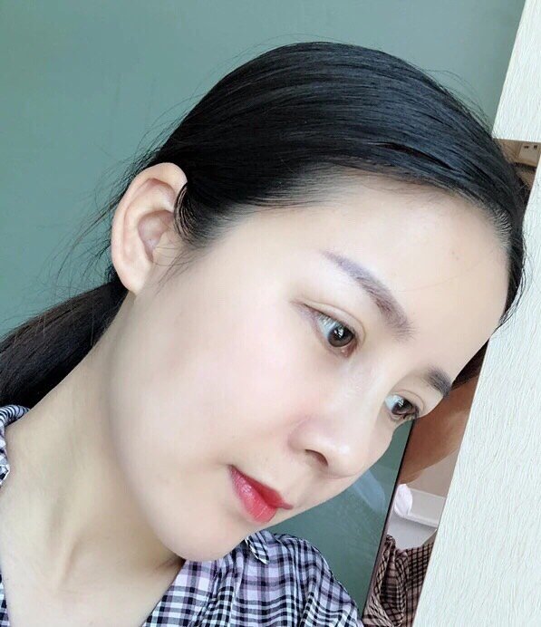 在没有做鼻子之前,我的鼻子属于那种短鼻子鼻头还比较_圈子-新氧美容