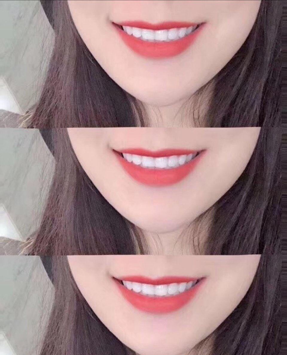 【冷光美白】送洗牙 进口牙齿美白技术,齿白七分俏,立现唇红齿白