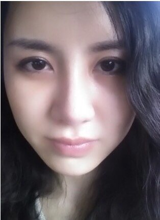 自然弧线/翘挺美鼻/不惧揉捏/进口假体隆鼻, 专属订制小翘鼻