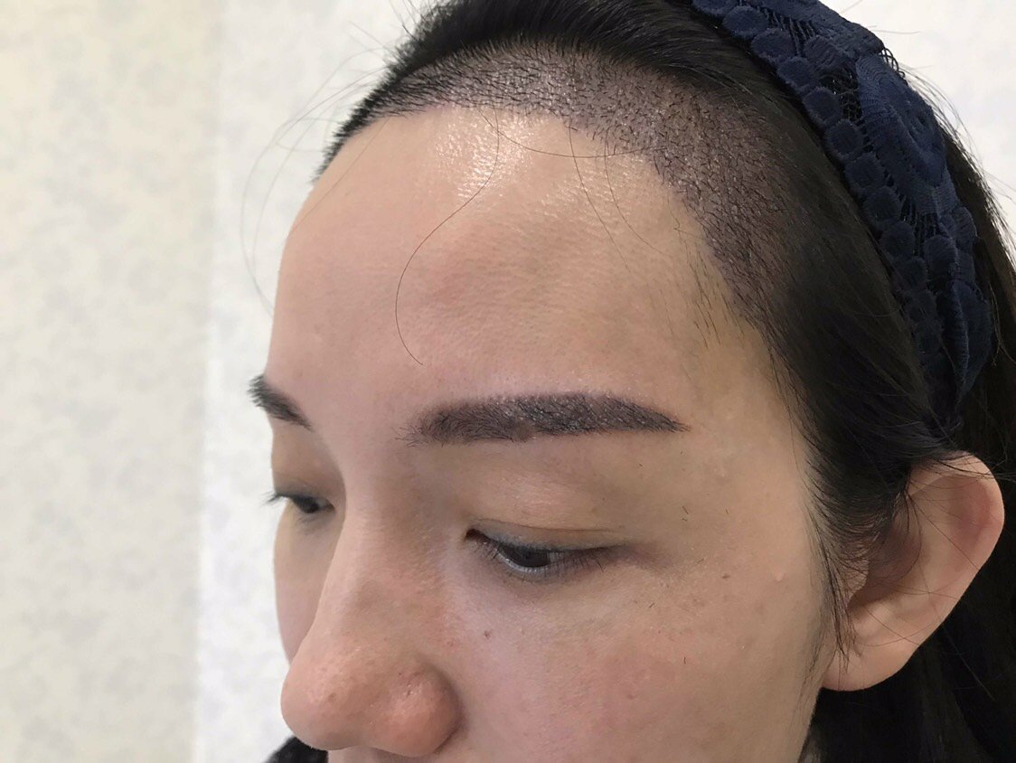 不管男生女生都一样,女生发际线过高会显得脸大,额头