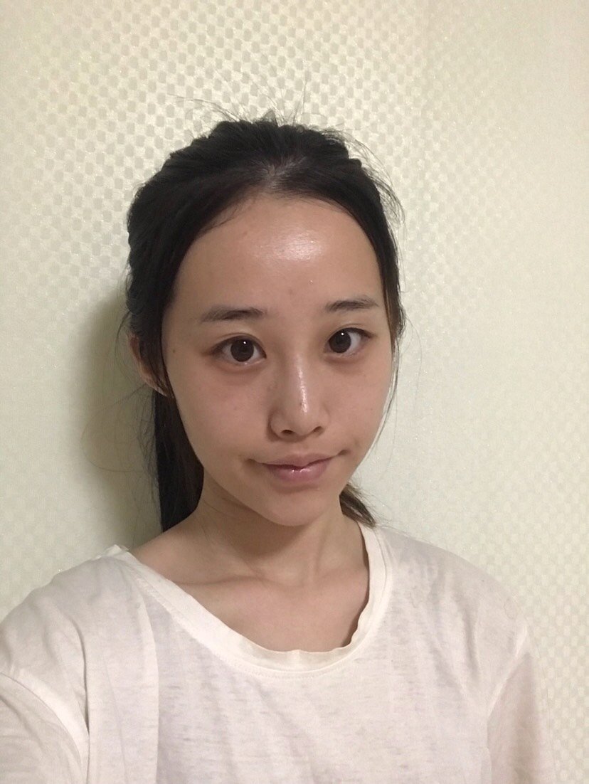 自己属于偏消瘦型,脸颊上的肉比较少,摸起来基本就是_圈子-新氧美容