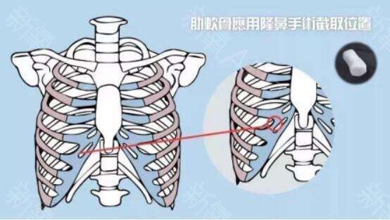 如何看待 你爱我就把你的肋骨取下来给 新氧美容整形