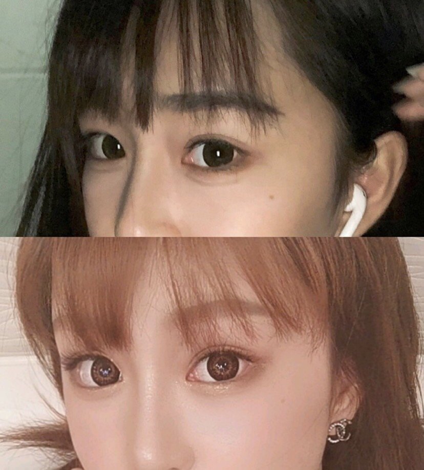 我之前的眼睛也不算小但是眼尾上扬,然后感觉有距离感_圈子-新氧美容