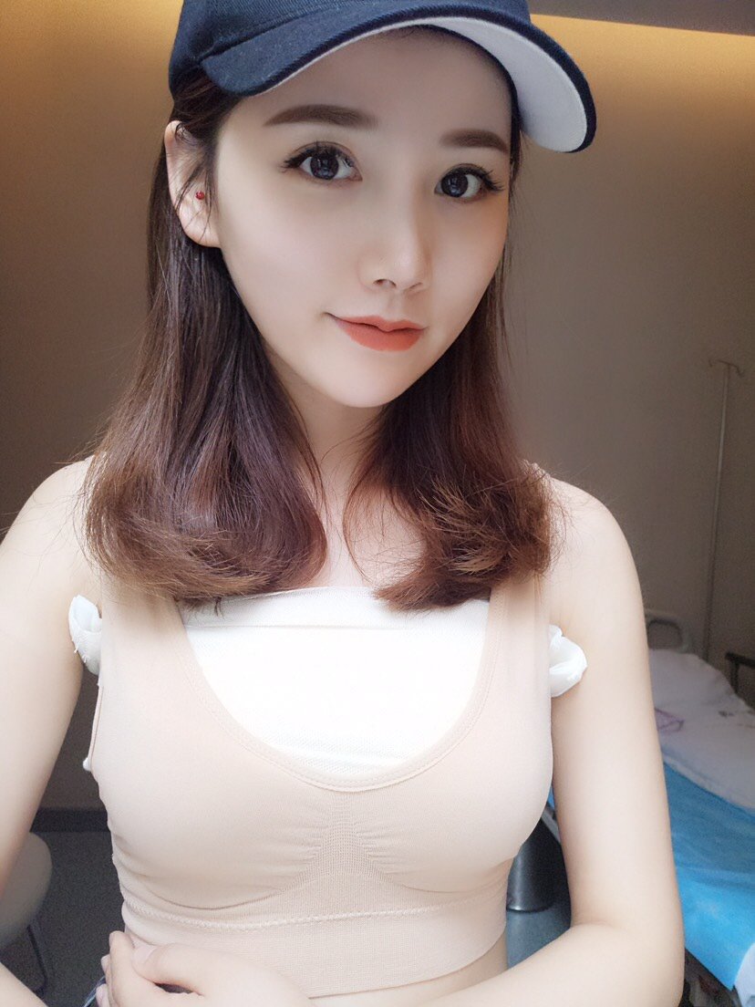 这个是刚刚拍的自体脂肪隆胸术后3个多月的照片,衣服_圈子-新氧美容