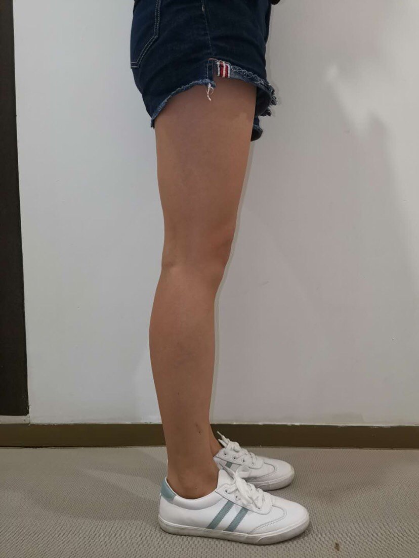 减肥好难,尤其是我这种管不住嘴的,大腿上的肉让我很_圈子-新氧美容