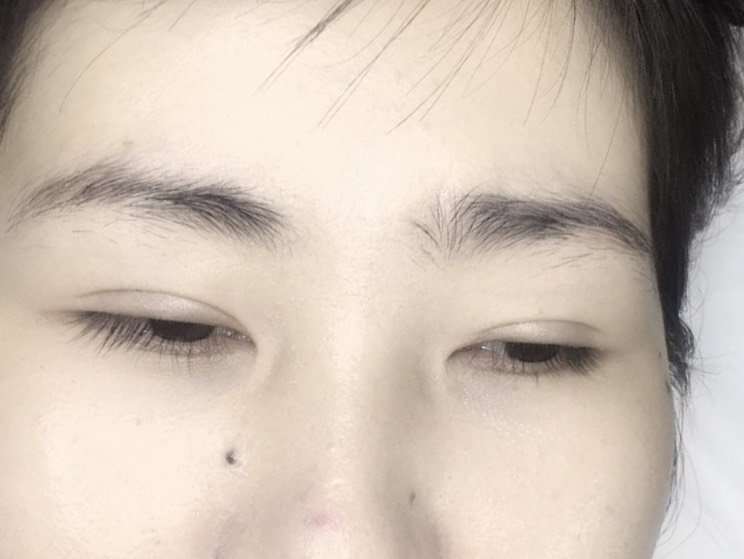 自己的眉毛长的比较乱两边很不对称做好的效果还是比较_圈子-新氧美容