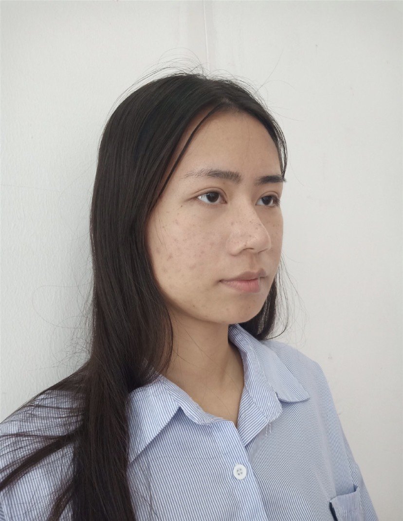 脸上的斑斑点点是在是太多了,自己都看不下去麻子脸了_圈子-新氧美容