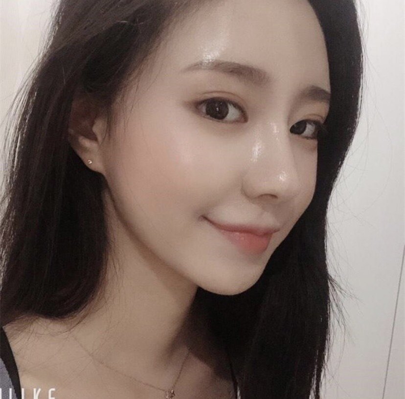 整张脸鼻子占三分之二既视感_圈子-新氧美容整形