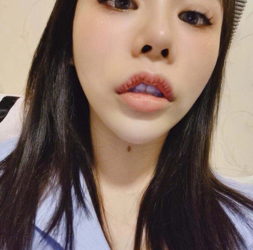 我做的m唇,现在的形状跟我之前完全不一样,改变真大_圈子-新氧美容