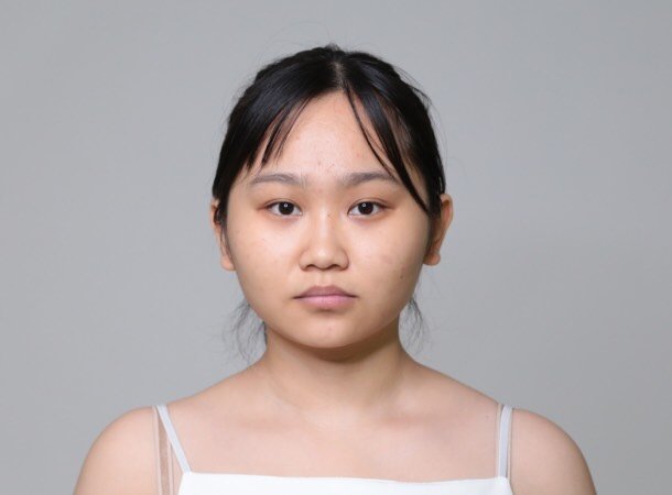 脸大太宽一直是我的心病,长久以来都只能披肩的发型,_圈子-新氧美容