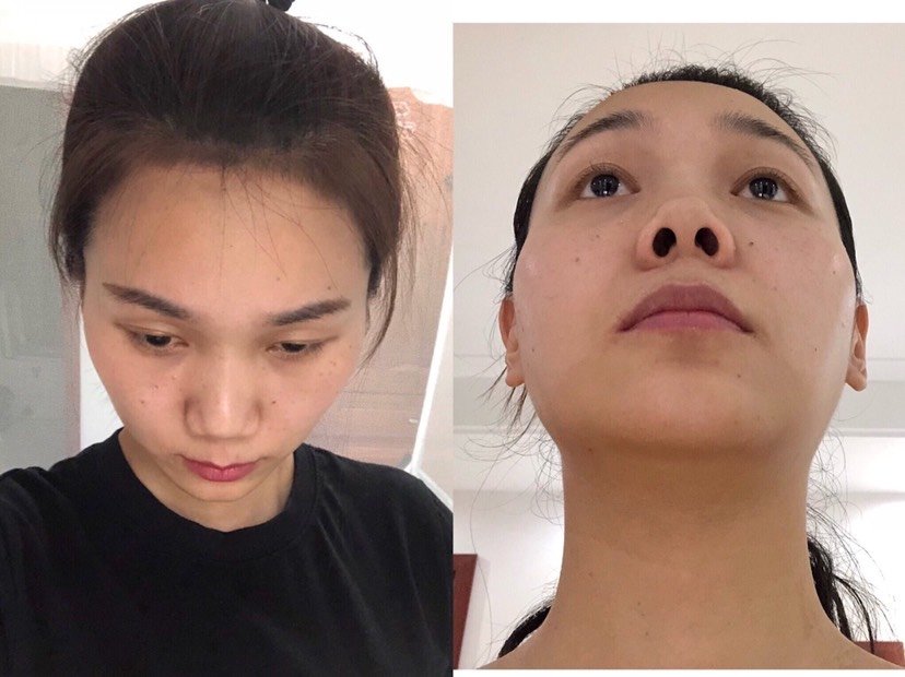 不想做平庸的中年大妈,如何给平淡无奇_新氧美容整形