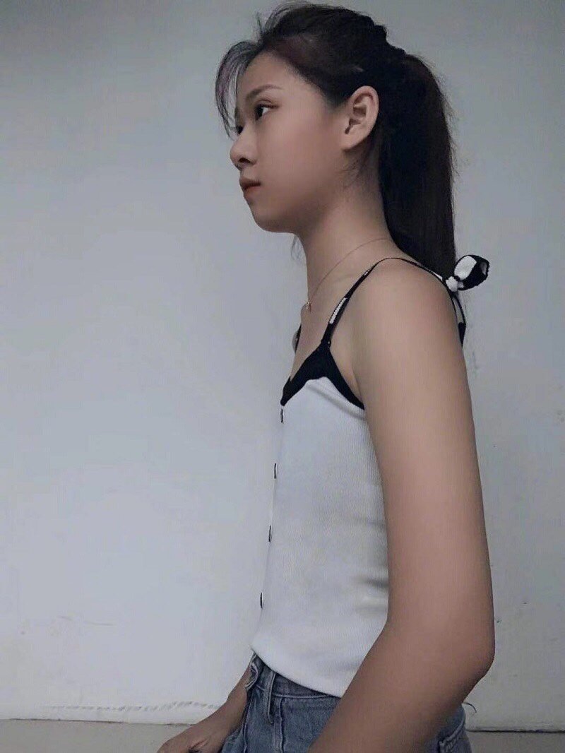 20多岁了,虽然很多人胸部还是平原,但我,恰恰是最_圈子-新氧美容整形